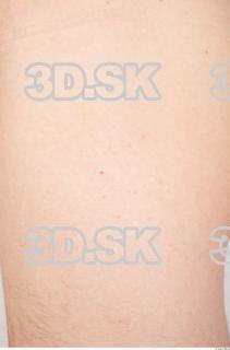 Skin texture of Oliver 0004